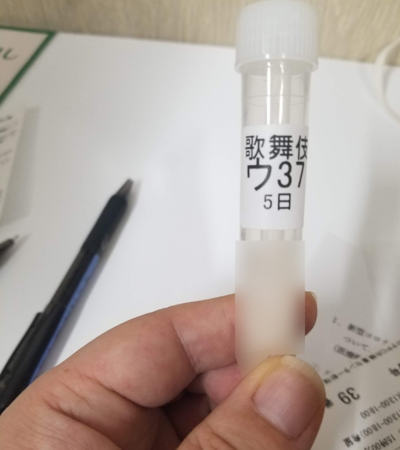 시험관에 타액 채취완료